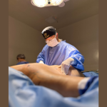 Milton Seigi Hayashi destaca que escolher entre abdominoplastia x lipo depende da flacidez, gordura localizada e expectativa final.
