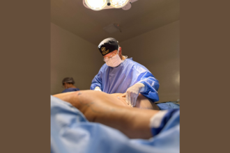 Milton Seigi Hayashi destaca que escolher entre abdominoplastia x lipo depende da flacidez, gordura localizada e expectativa final.